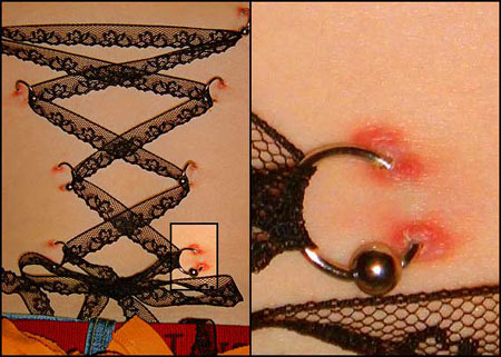 Tatuaze i Piercing. Gorset z kolczyk�w! poprzednie nastepne